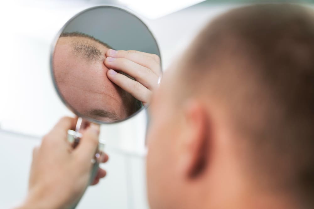 Day 10 After a Hair Transplant: What’s Normal, What to Do, and When to Call Your Clinic