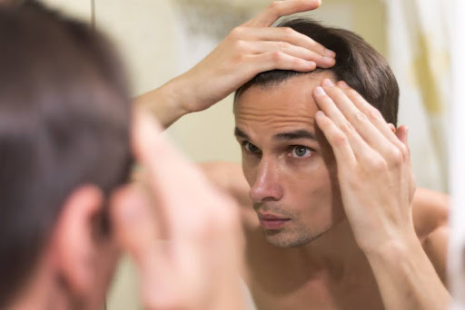 Mature vs. Receding Hairline: What’s the Real Difference?