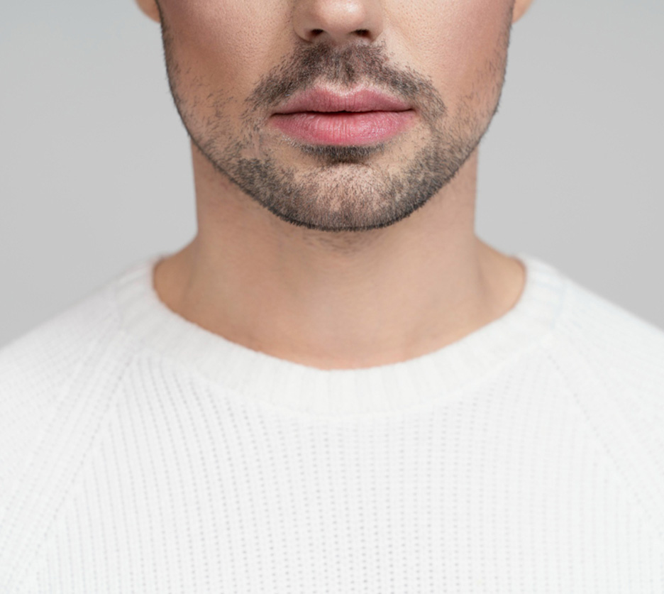 Moustache Hair Transplant