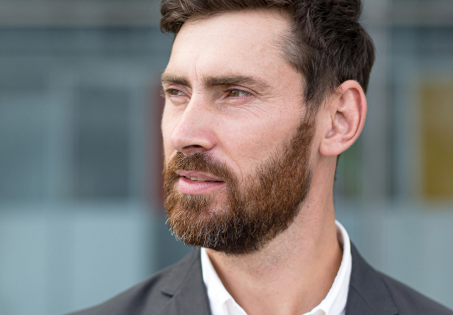 Good Candidate for Moustache Hair Transplant