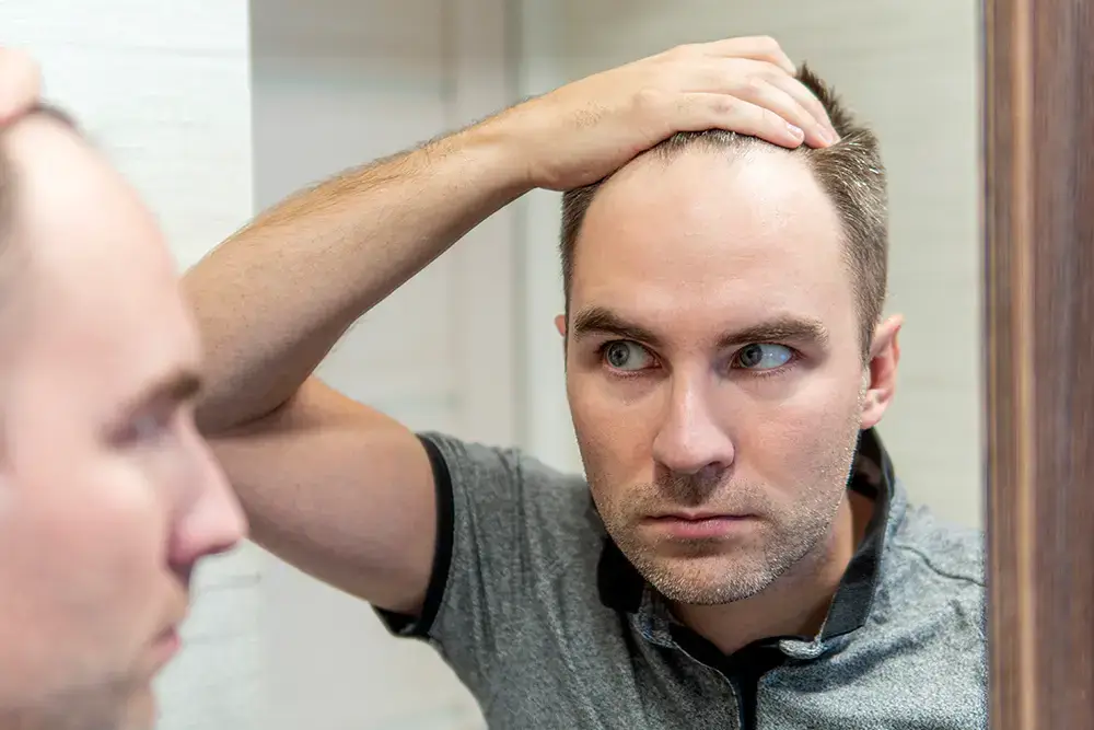 Does Phentermine Cause Hair Loss? A Comprehensive Guide