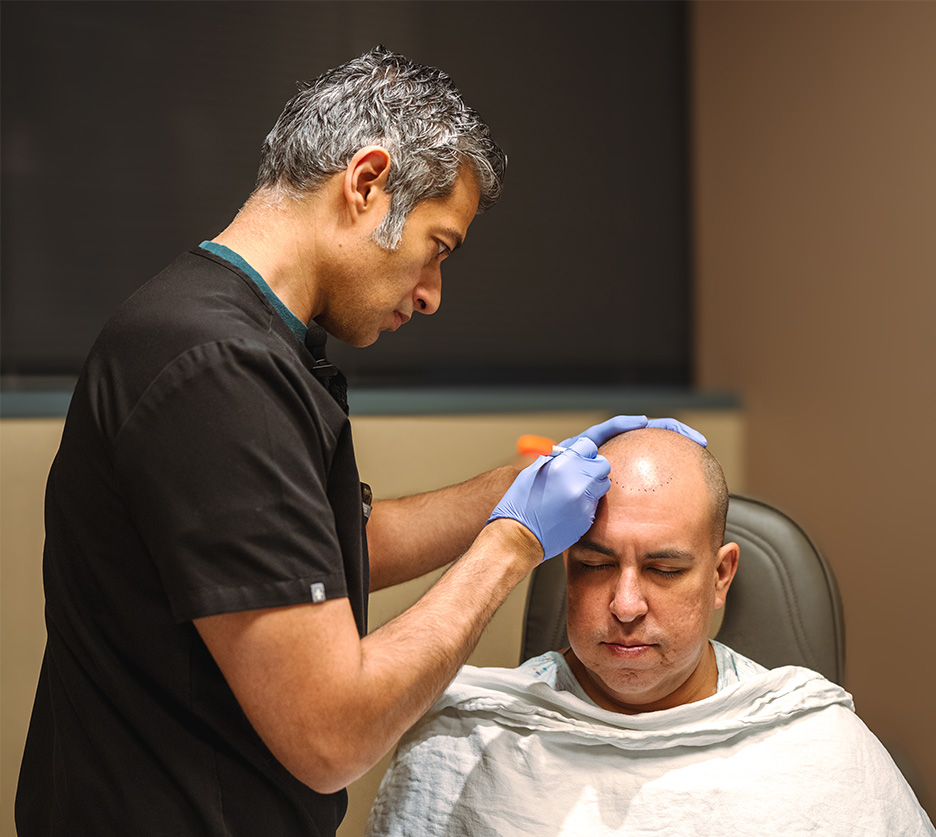 FUE Hair Transplant Spokane