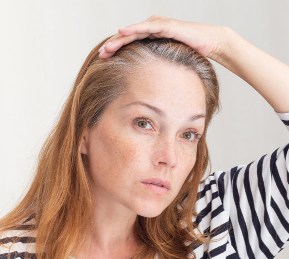 Long Hair Transplant in Seattle